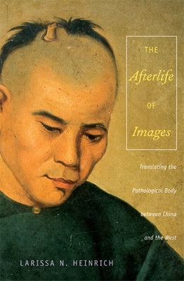The Afterlife of Images: Translating the Pathological Body between China and the West Paperback Duke University Press