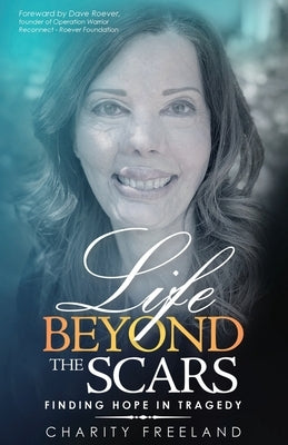 Life Beyond the Scars: Finding Hope in Tragedy Paperback Author Academy Elite
